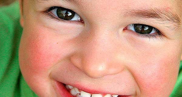  Psicopatologia en la infància i l'adolescència.